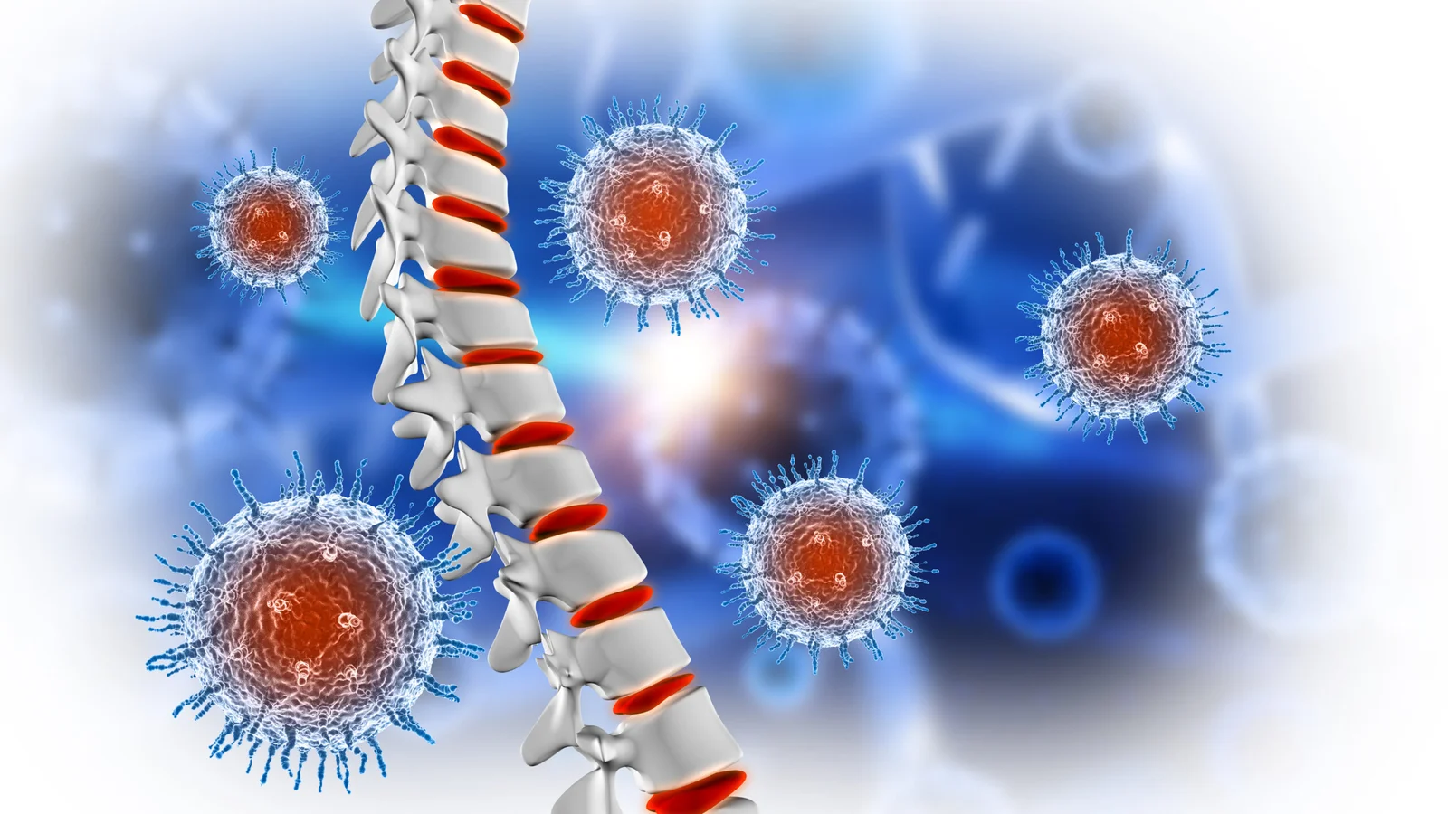 Spinal Infections