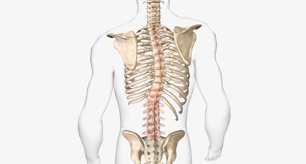 Scoliosis