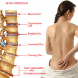Spine problem