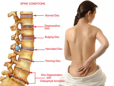 Spine-problem.png