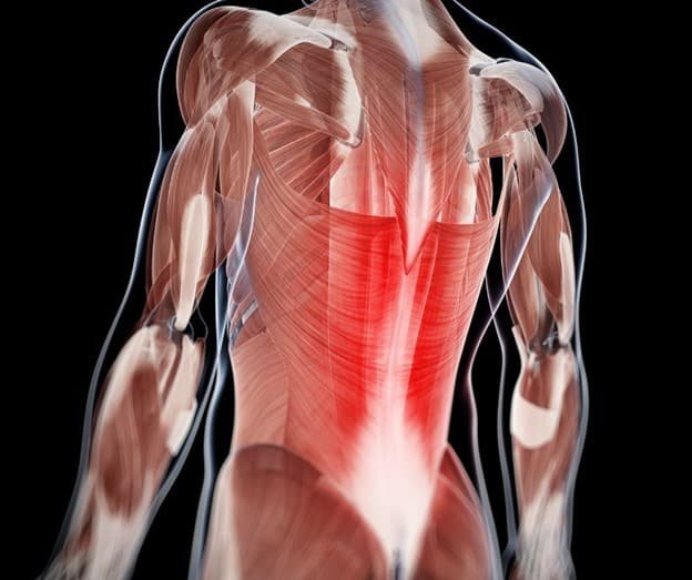 Weak-Spine-Muscles.jpg