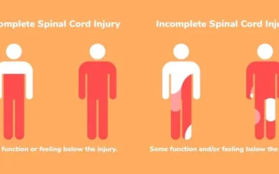 Classification of Spinal Cord Injuries