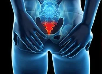 Coccydynia