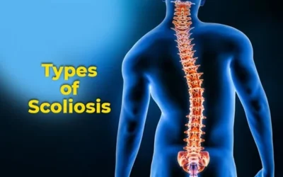 Understanding the Different Types of Scoliosis