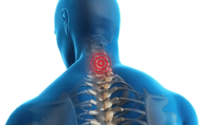 Cervical Spondylosis: Symptoms and Treatment