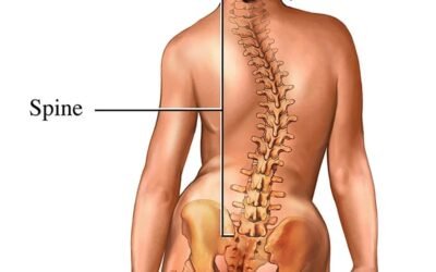 Scoliosis