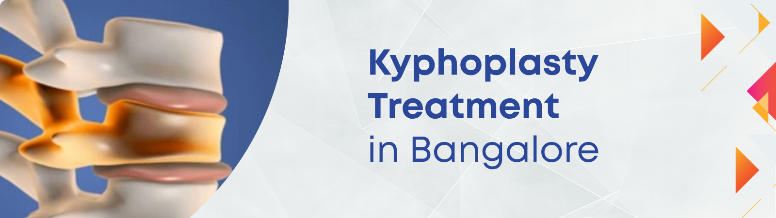 Banner advertising kyphoplasty treatment in bangalore, with a spine model on the left and blue text on a light background.