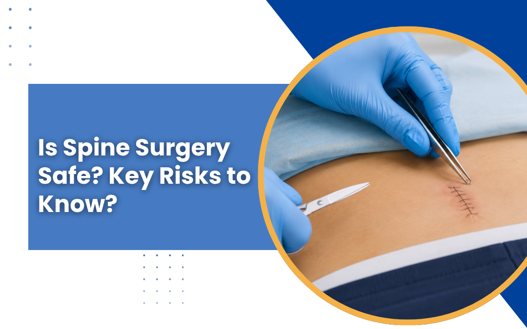  Is Spine Surgery Safe? Key Risks to Know?