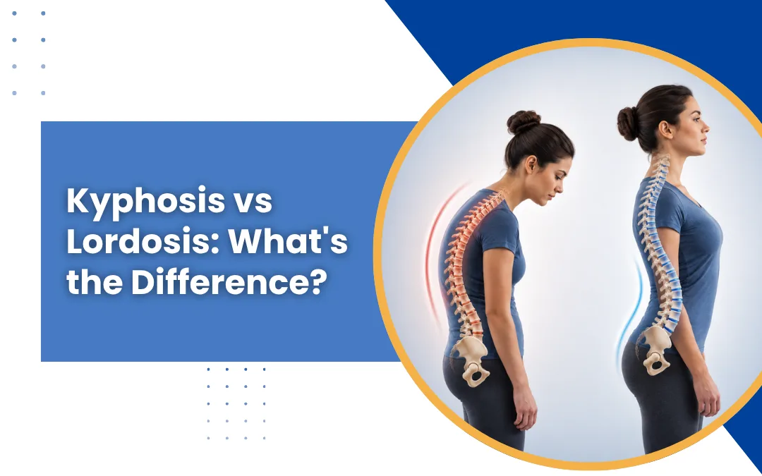 Kyphosis vs Lordosis: What’s the Difference?