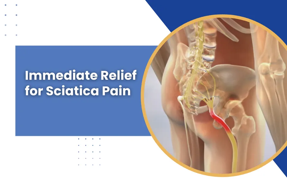 Immediate Relief for Sciatica Pain