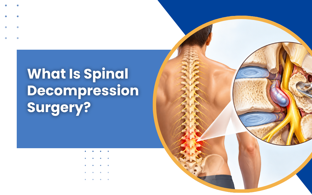 What Is Spinal Decompression Surgery?